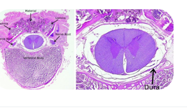 Two annotated decalcified haematoxylin and eosin stained sections through a vertebral body and spinal canal