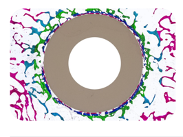 Histomorphometric analysis of new bone formation around a bioactive dowel