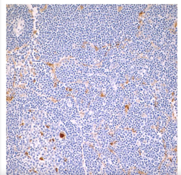 Immunohistochemistry section with Ram-11 positive cells stained brown against a counterstained background