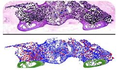 A methylene blue stained posterolateral fusion section shown above its colour-coded histomorphometric analysis