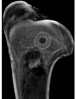 Microradiograph of a proximal humerus showing trabecular architecture around a cylindrical defect